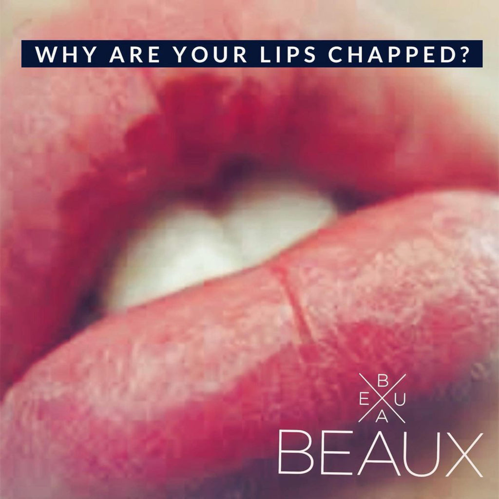 WHY ARE YOUR LIPS CHAPPED?